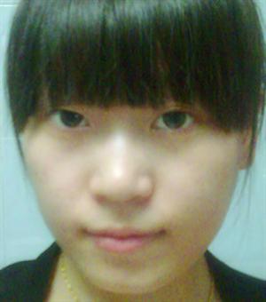孔林玲